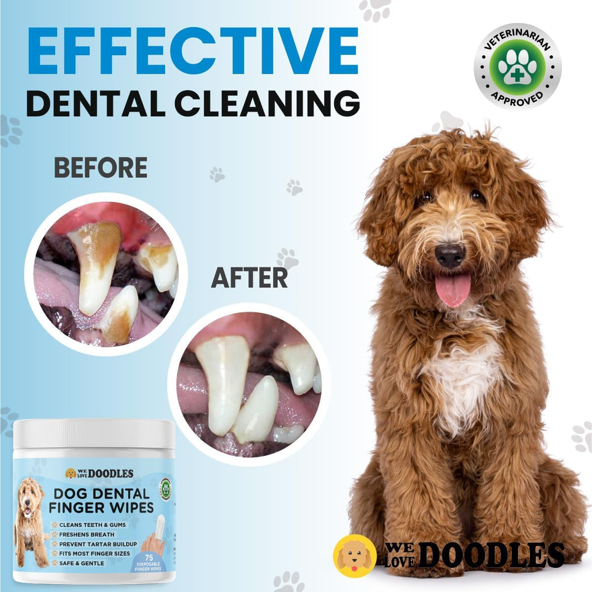 Dog Dental Finger Wipes (75 PCS)